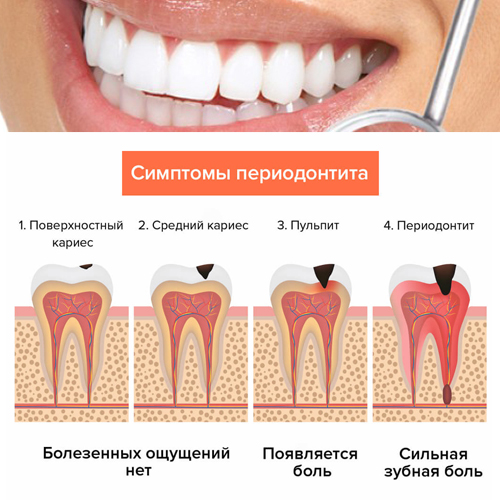 причины периодонтита