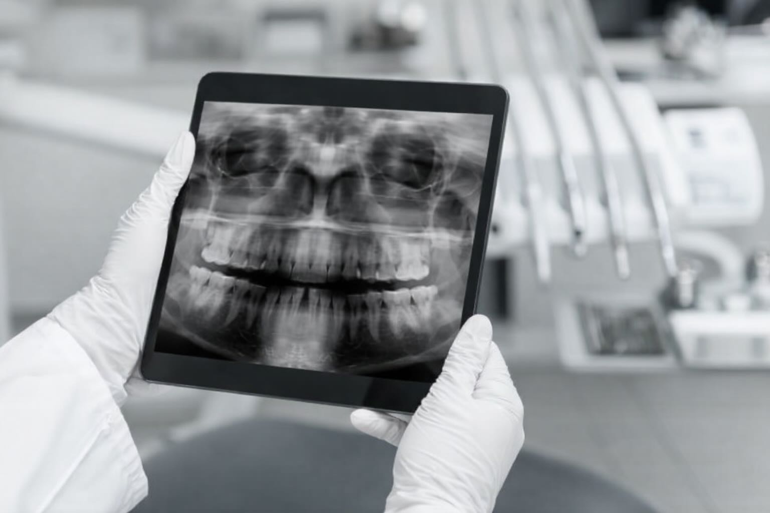 Диагностика перед имплантацией зубов