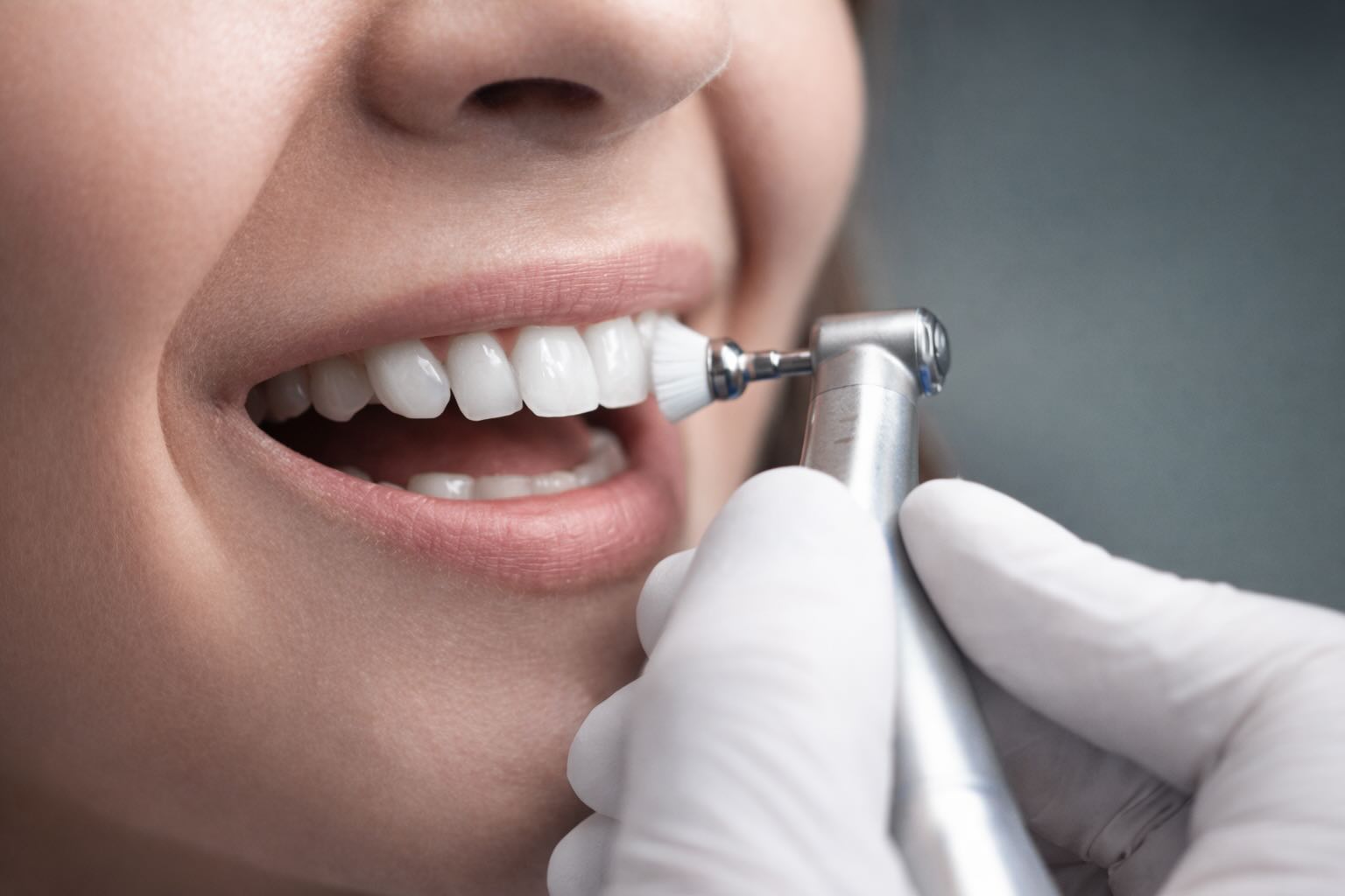 Ультразвуковая чистка зубов у стоматолога